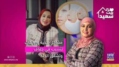 بيت سعيد مع زهرة عقيل | مشاكل صحية وروتينات تتسبب في جفاف وتشقق الجلد