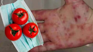 أنفلونزا الطماطم خطر جديد يهدد العالم بعد انتشارها فى الهند