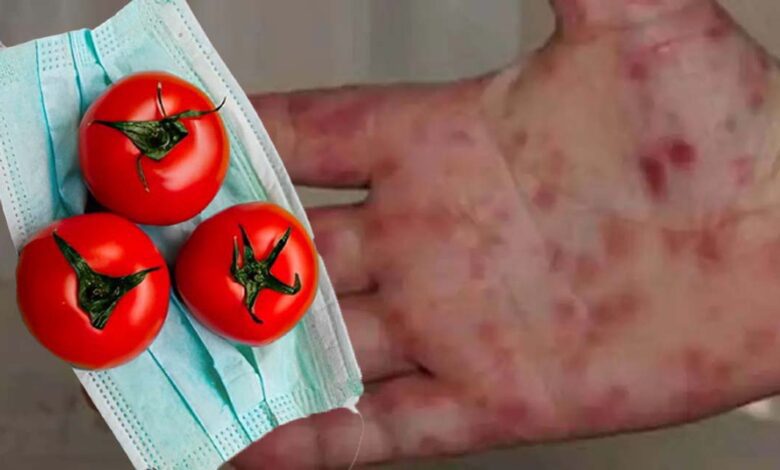 أنفلونزا الطماطم خطر جديد يهدد العالم بعد انتشارها فى الهند